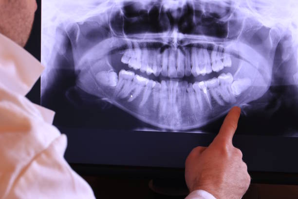 Best Emergency Dentist for Special Needs Patients in Linn, MO